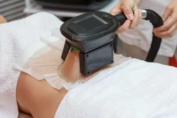 Image of person having fat freezing treatment to help weight gain Twyford