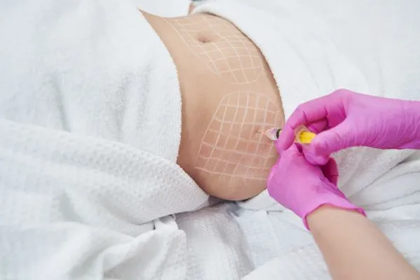 image of fat dissolving injections on love handles to help combat weight gain Twyford