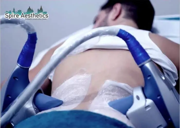 Man having fat freezing treatment done on love handles before a competitions Twyford to create a sculpted look.