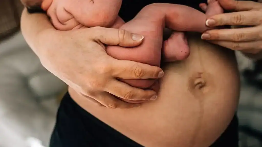 Why Is My Stomach Still Big After Pregnancy Twyford?